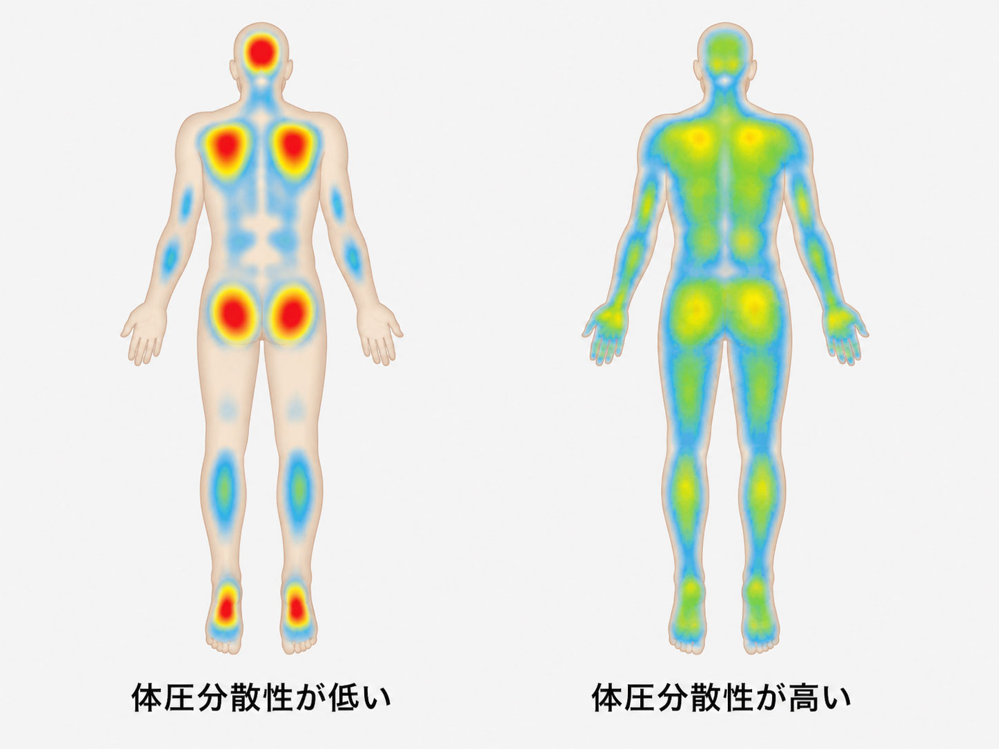 体圧分布図の例